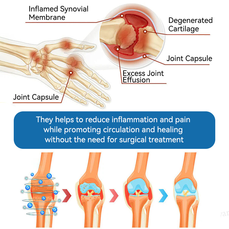 🐨Made and shipped from Australia✅ Tiworld™ BPC-157 Joint Healing Cream