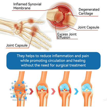 🐨Made and shipped from Australia✅ Tiworld™ BPC-157 Joint Healing Cream
