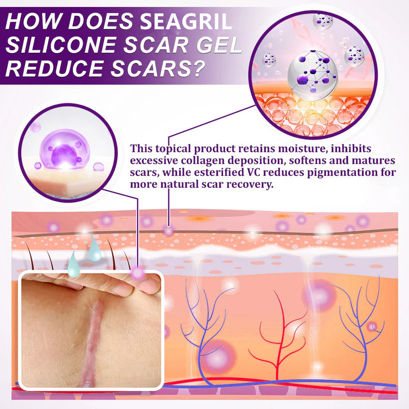 SEAGRIL™ Scar Gel –  Clinically Proven Formula to Soften, Flatten & Fade Scars from Surgery, Acne, Burns, and Keloids