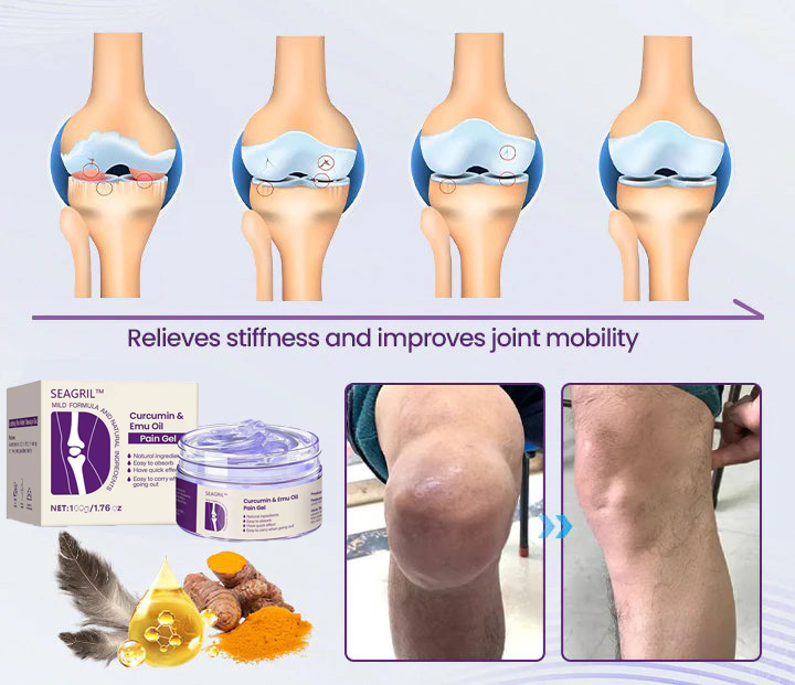 SEAGRIL™ Curcumin & Emu Oil Pain Gel – 🏥Backed by US Osteopathic Experts