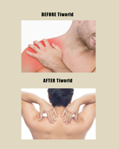 Tiworld Bee Venom & Turmeric Arthritis Therapy Cream