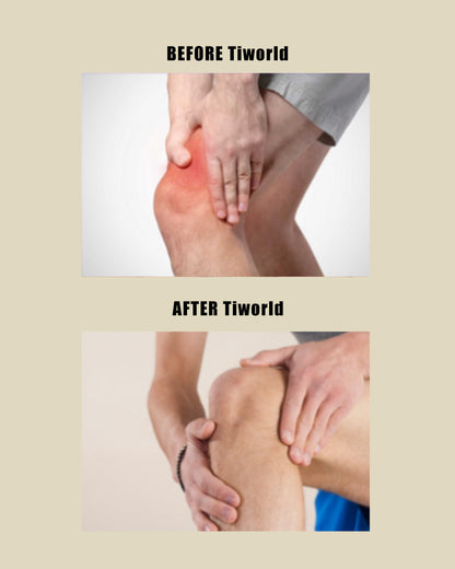 Tiworld Bee Venom & Turmeric Arthritis Therapy Cream