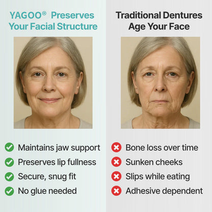 🔥🔥🔥Ends Today: 70% OFF!🦷 Yagoo® Custom-Fit Full Functional Dentures Make you more confident