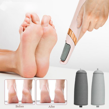 🔥 Last 3 Hours – 69% OFF! Rechargeable Electric Callus Remover for Smooth, Baby-Soft Feet ✨
