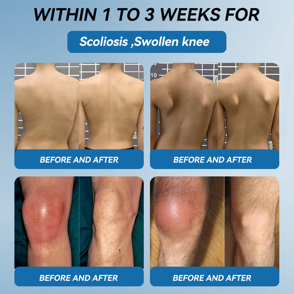 🐨Made and shipped from Australia✅ Tiworld™ BPC-157 Joint Healing Cream