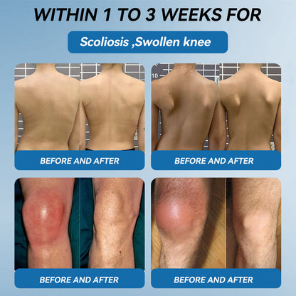 🐨Made and shipped from Australia✅ Tiworld™ BPC-157 Joint Healing Cream