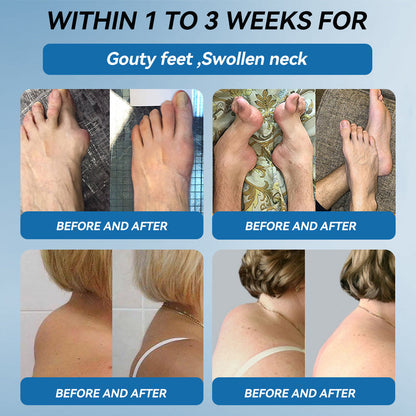 🐨Made and shipped from Australia✅ Tiworld™ BPC-157 Joint Healing Cream